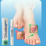 Orivelle Fungus Pen