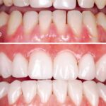 EVO Purple Toothpaste