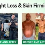 CleraLuxe BrownFat Microneedle Patch