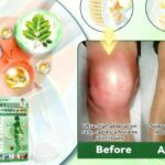 SurgoNix Moringa Patch