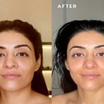 Kojeva Lymphatic Face Brush