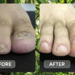 Fuente Stem Cell Gel