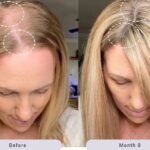 Bloomly Hair Remover